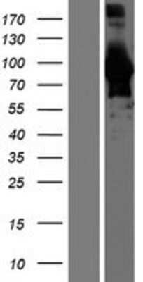 Western Blot: BIN1 Overexpression Lysate [NBP2-09976]