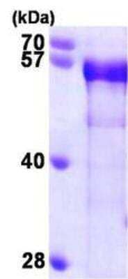 Western Blot: Recombinant Human BIN1 His Protein [NBP1-45322]