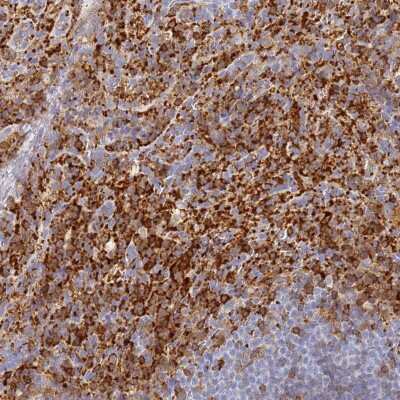 Immunohistochemistry: BIN2 Antibody [NBP2-48691]