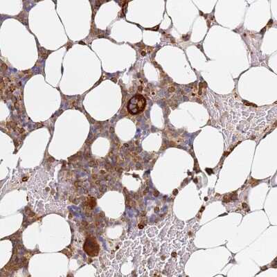 Immunohistochemistry-Paraffin: BIN2 Antibody [NBP2-48690]