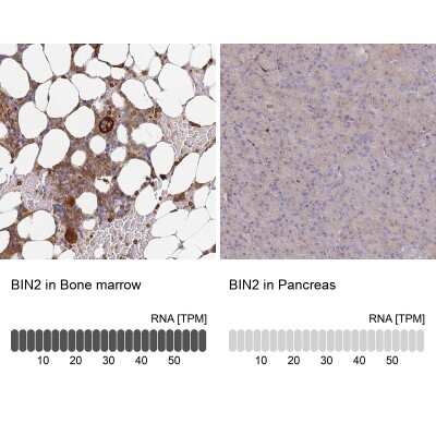 Immunohistochemistry-Paraffin: BIN2 Antibody [NBP2-48690]