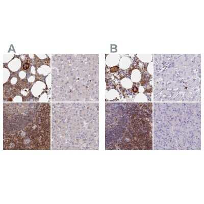 Immunohistochemistry-Paraffin: BIN2 Antibody [NBP2-48690]