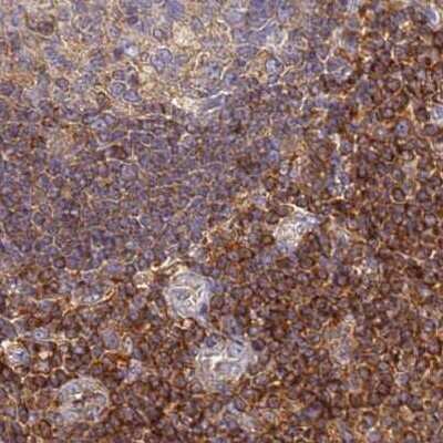 Immunohistochemistry-Paraffin: BIN2 Antibody [NBP2-48690]