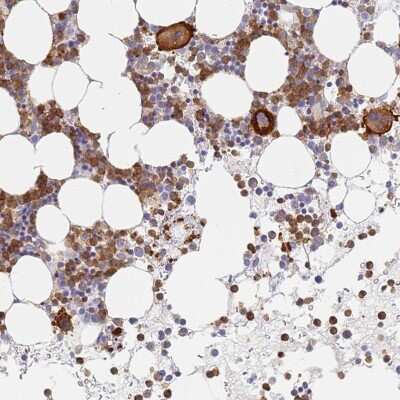 Immunohistochemistry-Paraffin: BIN2 Antibody [NBP2-48691]