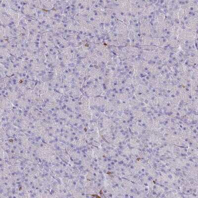Immunohistochemistry-Paraffin: BIN2 Antibody [NBP2-48691]