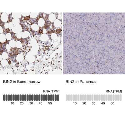 Immunohistochemistry-Paraffin: BIN2 Antibody [NBP2-48691]