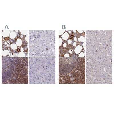 Immunohistochemistry-Paraffin: BIN2 Antibody [NBP2-48691]