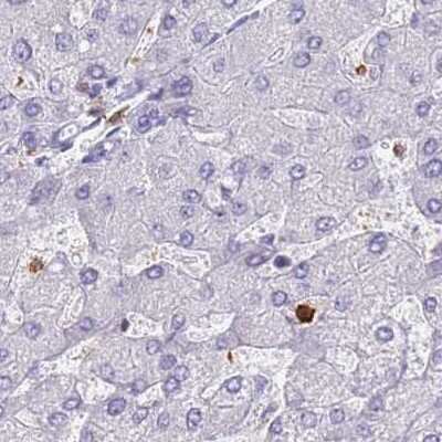 Immunohistochemistry-Paraffin: BIN2 Antibody [NBP2-48691]