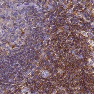 Immunohistochemistry-Paraffin: BIN2 Antibody [NBP2-48691]