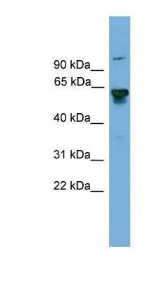 Western Blot: BIN2 Antibody [NBP1-79648]