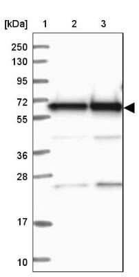 Western Blot: BIN2 Antibody [NBP2-48690]