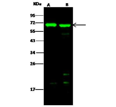 Western Blot: BIN2 Antibody [NBP2-97015]