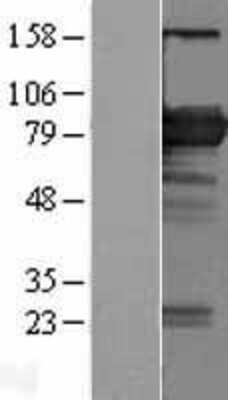 Western Blot: BIN2 Overexpression Lysate [NBL1-07982]