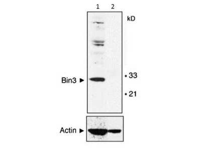 Western Blot: BIN3 Antibody (3A4) [NBP2-21676]