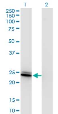 Western Blot: BIN3 Antibody (4E12) [H00055909-M09]