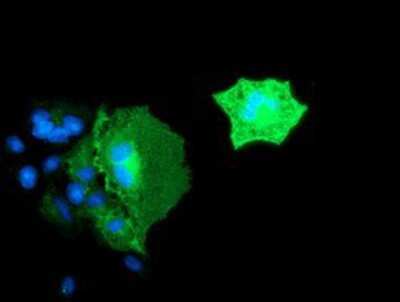 Immunocytochemistry/ Immunofluorescence: BIN3 Antibody (OTI8E9) [NBP2-03389]