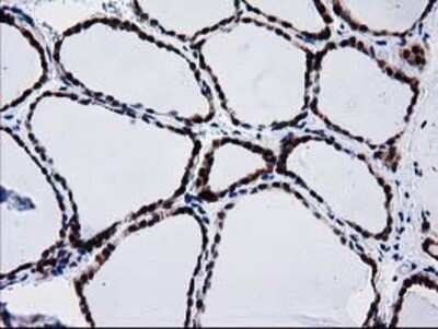 Immunohistochemistry-Paraffin: BIN3 Antibody (OTI8E9) [NBP2-03389]