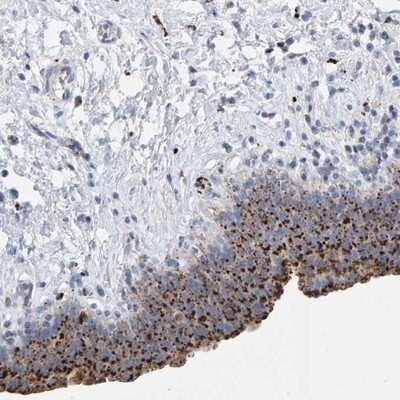 Immunohistochemistry-Paraffin: BIN3 Antibody [NBP1-85988]