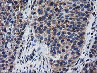Immunohistochemistry: BIN3 Antibody (OTI8E9) - Azide and BSA Free [NBP2-72051]
