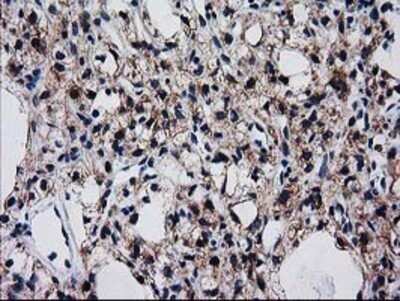 Immunohistochemistry: BIN3 Antibody (OTI8E9) - Azide and BSA Free [NBP2-72051]
