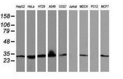 Western Blot: BIN3 Antibody (OTI8E9)Azide and BSA Free [NBP2-72051]
