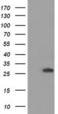 Western Blot: BIN3 Antibody (OTI8E9)Azide and BSA Free [NBP2-72051]