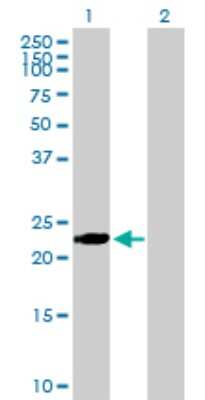 Western Blot: BIN3 Antibody [H00055909-B01P]