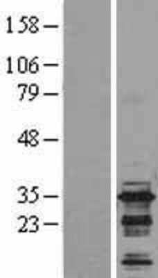 Western Blot: BIN3 Overexpression Lysate [NBL1-07983]