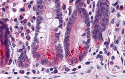 Immunohistochemistry: BIRC6 Antibody - BSA Free [NBP2-81962]