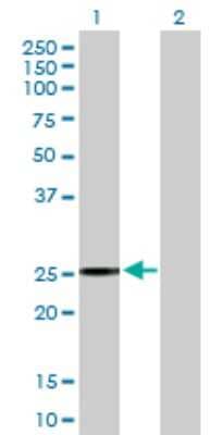 Western Blot: BIRC8 Antibody [H00112401-B01P]