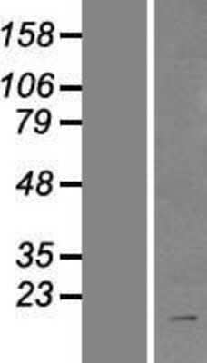 Western Blot: BIRC8 Overexpression Lysate [NBP2-05890]