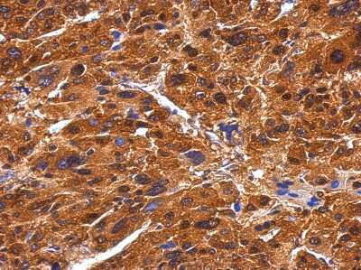 Immunohistochemistry-Paraffin: BIVM Antibody [NBP1-31214]