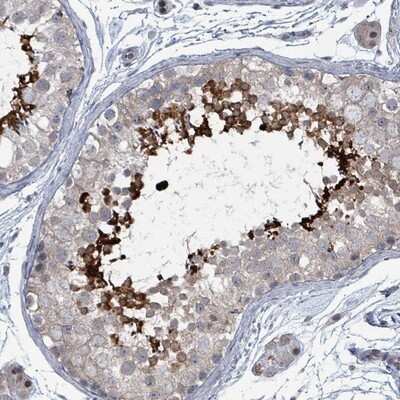 Immunohistochemistry-Paraffin: BIVM Antibody [NBP2-14354]