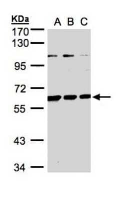 Western Blot: BIVM Antibody [NBP1-31214]