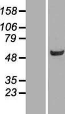 Western Blot: BIVM Overexpression Lysate [NBP2-06939]