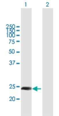 Western Blot: BJHCC20A Antibody [H00054967-B01P]