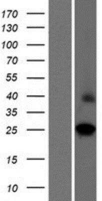 Western Blot: BJHCC20A Overexpression Lysate [NBP2-06906]