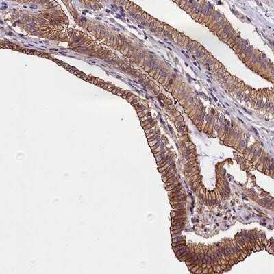 Immunohistochemistry-Paraffin: BLACE Antibody [NBP1-90970]
