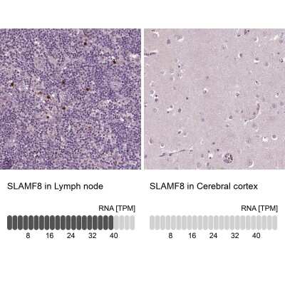 Immunohistochemistry-Paraffin: BLAME/SLAMF8 Antibody [NBP2-56595]