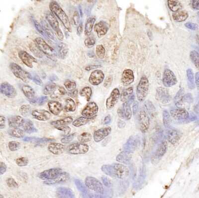 Immunohistochemistry-Paraffin: BLAP75 Antibody [NB100-1720]