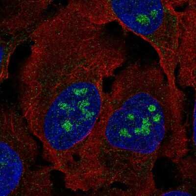 Immunocytochemistry/ Immunofluorescence: BLCAP Antibody [NBP2-54983]