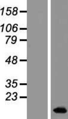 Western Blot: BLCAP Overexpression Lysate [NBL1-07989]