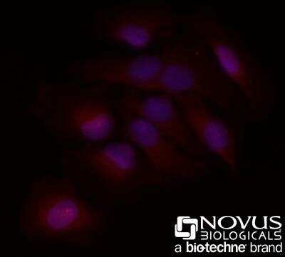 Immunocytochemistry/ Immunofluorescence: BLIMP1/PRDM1 Antibody (3H2-E8) - BSA Free [NB600-235]