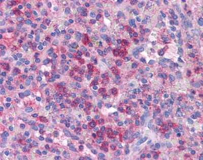 Immunohistochemistry: BLIMP1/PRDM1 Antibody [NBP3-10875]