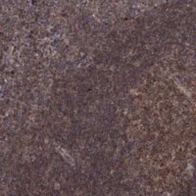 Immunohistochemistry-Paraffin: BLIMP1/PRDM1 Antibody [NBP3-17184]