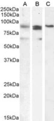 Western Blot: BLIMP1/PRDM1 Antibody [NBP1-51991]