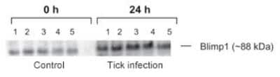 Western Blot: BLIMP1/PRDM1 Antibody [NBP2-27180]