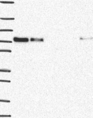 Western Blot: BLIMP1/PRDM1 Antibody [NBP3-17184]