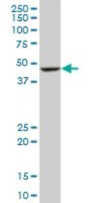 Western Blot: BLMH/Bleomycin Hydrolase Antibody (4A2) [H00000642-M02]