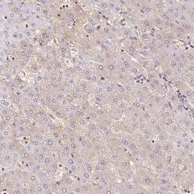 Immunohistochemistry-Paraffin: BLMH/Bleomycin Hydrolase Antibody [NBP1-88640]